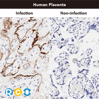 2025年末狂欢大放送，购买GeneTex抗体、京东礼品卡送给您