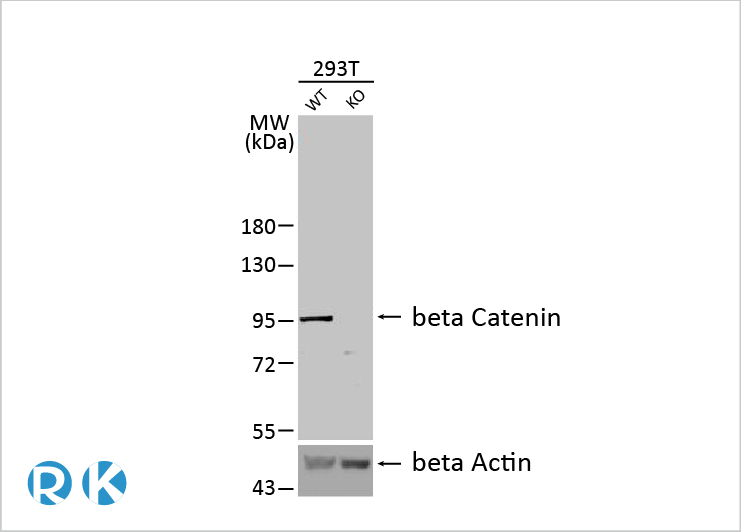 MDM2抑制剂在ELP1突变型Sonic Hedgehog髓母细胞瘤的治疗潜力