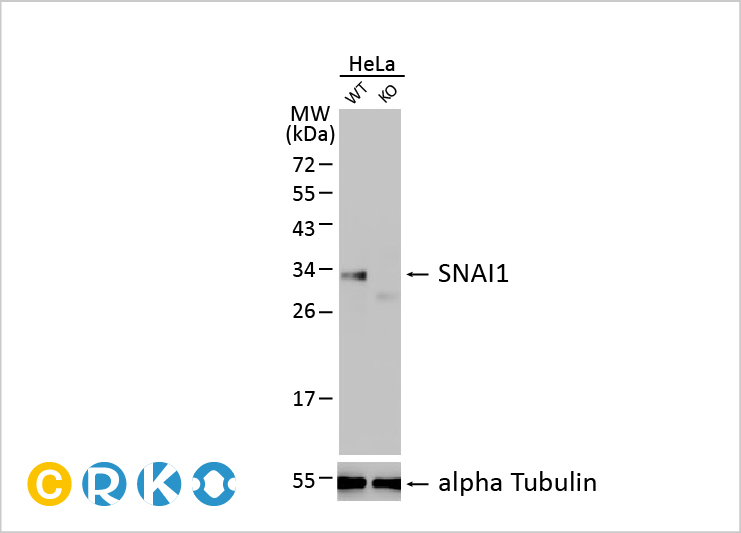 MDM2抑制剂在ELP1突变型Sonic Hedgehog髓母细胞瘤的治疗潜力