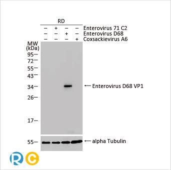 2025年末狂欢大放送，购买GeneTex抗体、京东礼品卡送给您