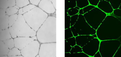 Matrix Gel/基质胶如何用于支持体外血管生成？