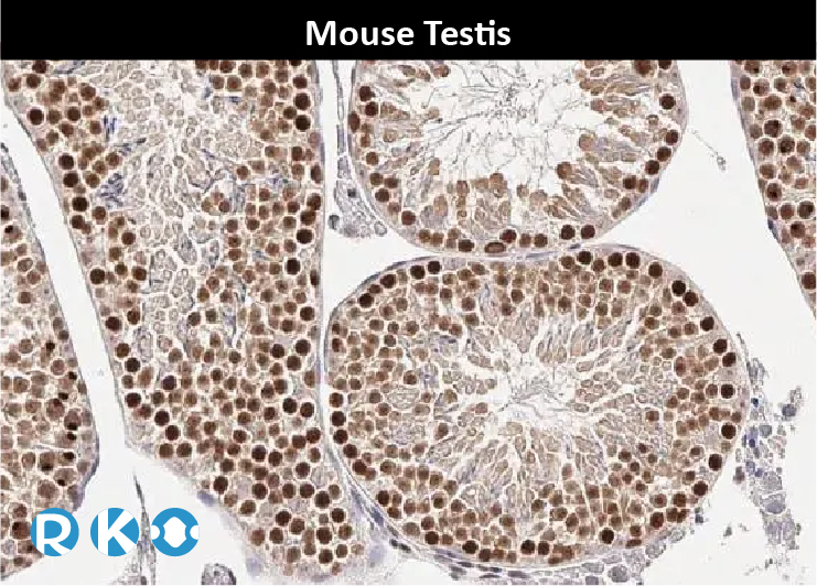 MDM2抑制剂在ELP1突变型Sonic Hedgehog髓母细胞瘤的治疗潜力