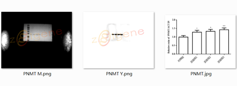 蛋白免疫印迹实验（WB）