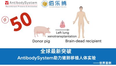 喜报 | 全球首例！AntibodySystem抗体助力中国团队首次尝试猪肺移植人体新突破