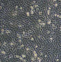 人黑色素瘤细胞株;A375 (STR)