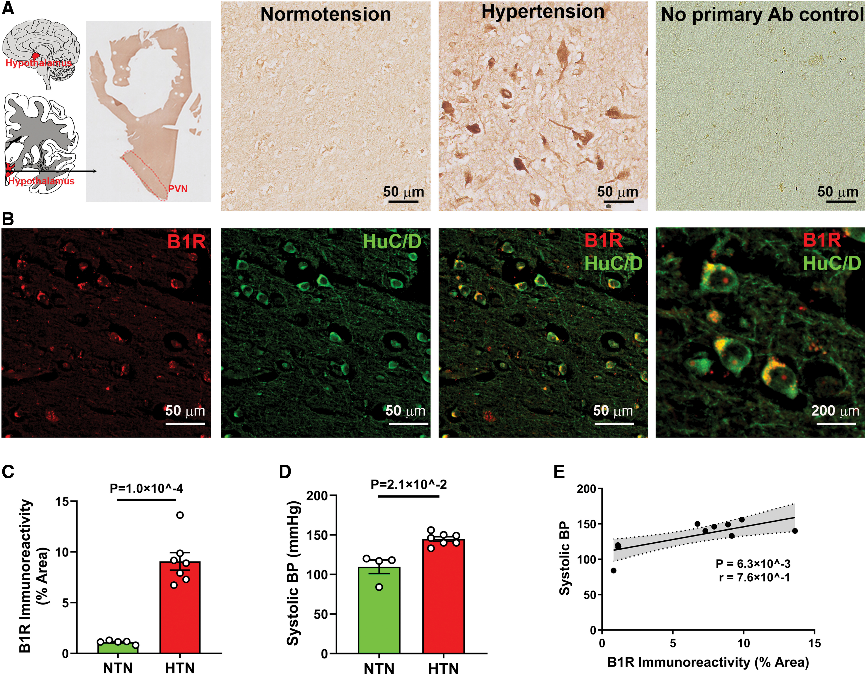6389173387921382798829225