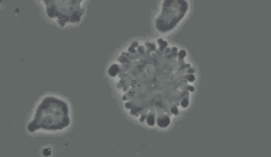 组织驻留记忆样NK细胞的研究进展