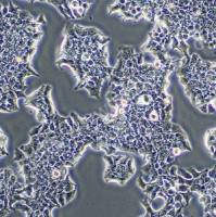 人乳腺导管癌细胞;BT474 (STR)