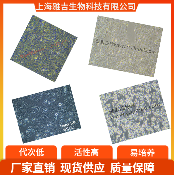 小鼠肉瘤成纤维细胞CCRFS180II技术新闻