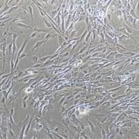 人肺动脉成纤维细胞-永生化