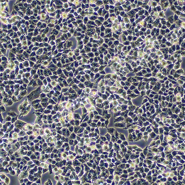 人卵巢癌细胞；A2780 (STR)