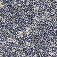 人卵巢癌细胞;A2780 (STR)