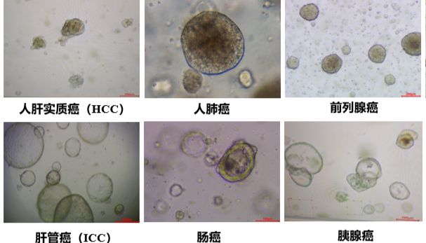 类器官培养解决方案