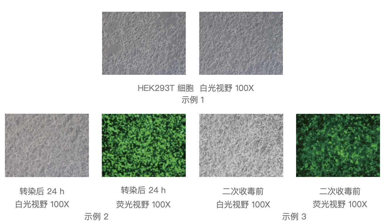 慢病毒包装试剂盒