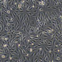 人脐静脉融合细胞;EAhy926 (STR)