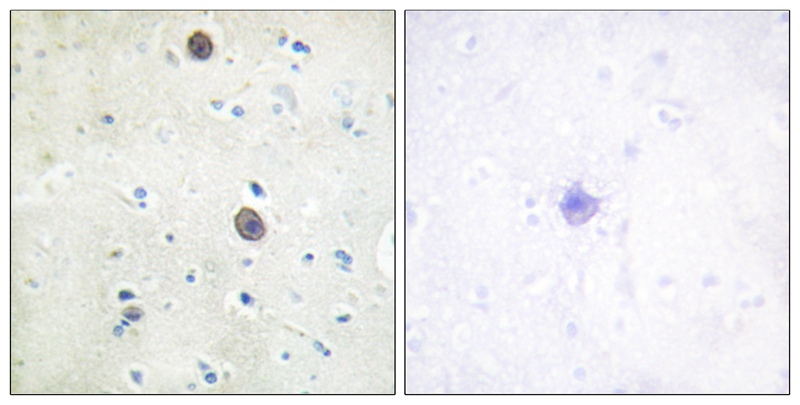 Amyloid β A4 (Phospho-Thr743/6