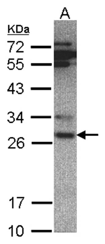 20S Proteasome alpha 6 antibod