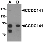 CCDC141 Antibody