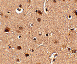 Slitrk4 Antibody