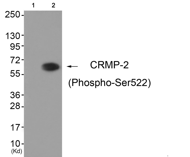 CRMP-2 (Phospho-Ser522) Antibo