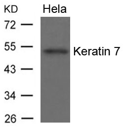 Keratin 7 Antibody