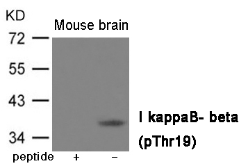 IkappaB- beta (Phospho-Thr19)