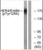 HER4 (Phospho-Tyr1284) Antibod
