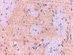 GPAT1 Antibody