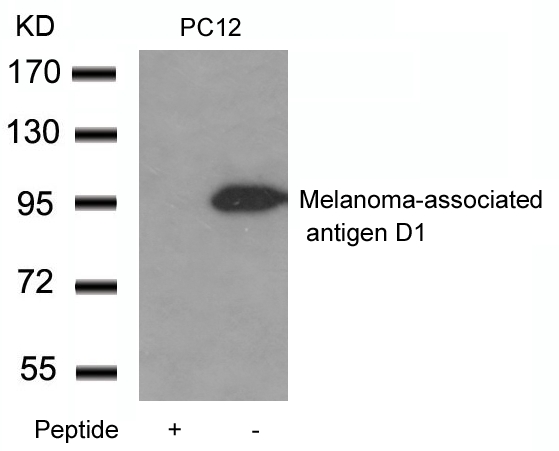 Melanoma-associated antigen D1