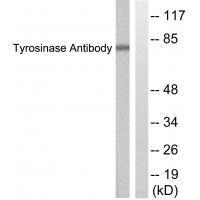 Tyrosinase Antibody