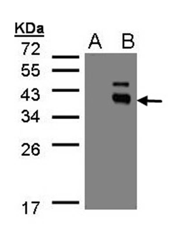 PPM1K antibody