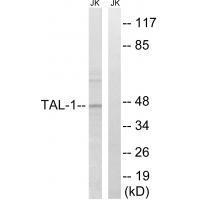 TAL-1   Antibody