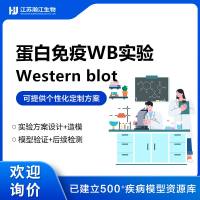 WB实验（Western blot）