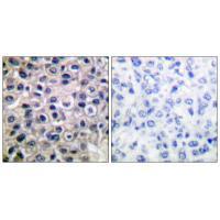 MMP-14 Antibody