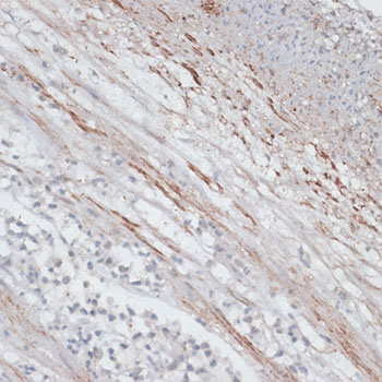 TPM1 Antibody