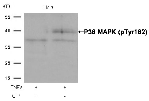 P38 MAPK(Phospho-Tyr182) Antib