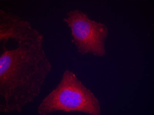 GSK3α/β(Phospho-Tyr279/216) An