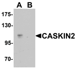 CASKIN2 Antibody
