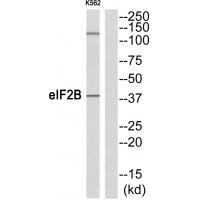 eIF2B   Antibody