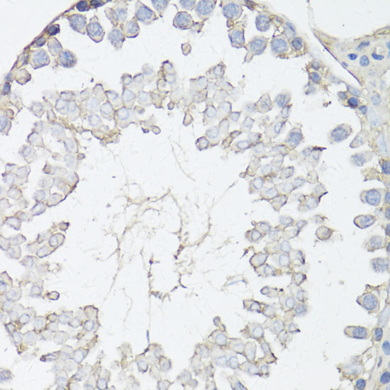 ABCC4 Antibody