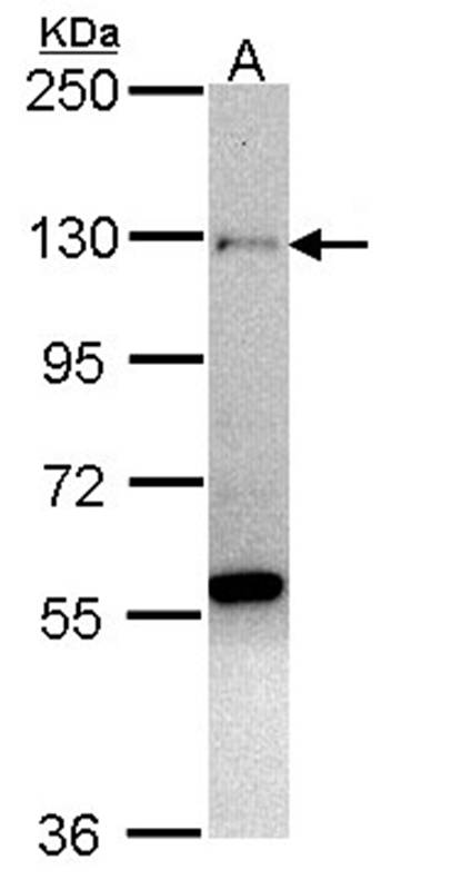 zinc finger protein 574 antibo