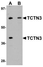 TCTN3 Antibody