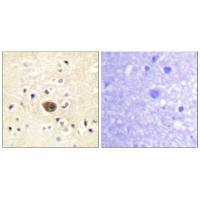 Ras-GRF1 Antibody