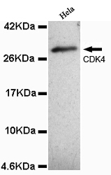CDK4(N-term) Monoclonal Antibo