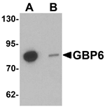 GBP6 Antibody