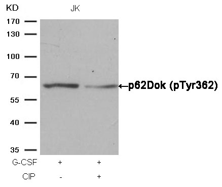 p62Dok(phospho-Tyr362) Antibod