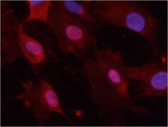 GSK3α/β(Phospho-Tyr279/216) An