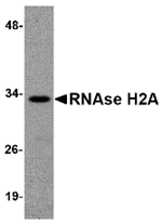 RNAse H2A Antibody