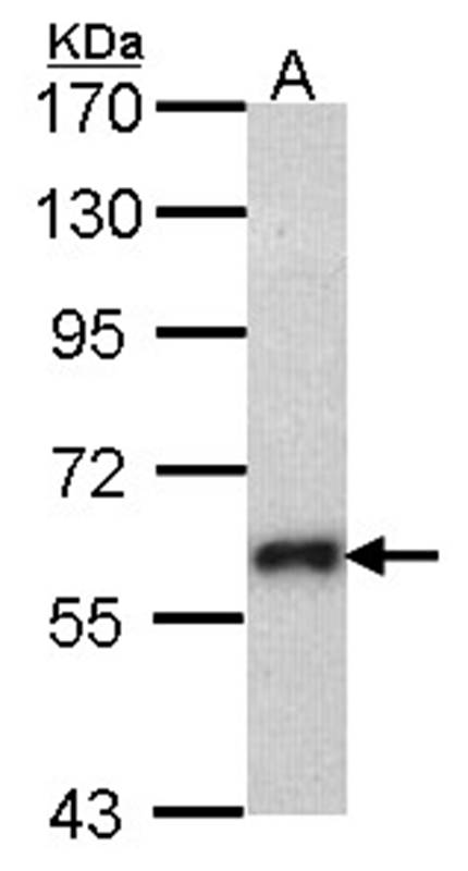 SOCS5 antibody
