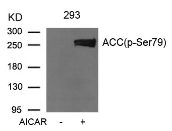 Acetyl-CoA Carboxylase (Phosph
